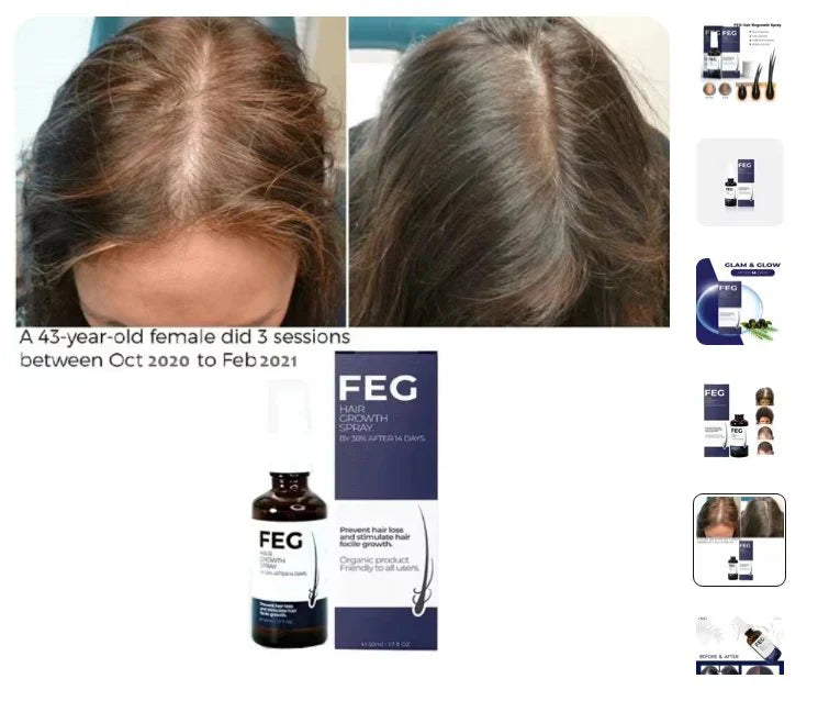 FEG Hair Growth Spray Dubai | Fast Hair Regrowth Solution