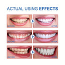 SP-6 Ultra Whitening Toothpaste | Best Whitening Toothpaste