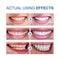 SP-6 Ultra Whitening Toothpaste | Best Whitening Toothpaste