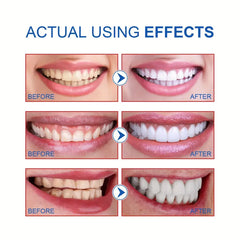 SP-6 Ultra Whitening Toothpaste | Best Whitening Toothpaste